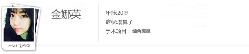 北京做综合隆鼻多少钱?哪家医院做的好?