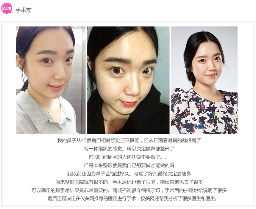北京做综合隆鼻多少钱?哪家医院做的好?