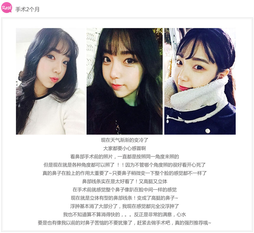 北京做综合隆鼻多少钱?哪家医院做的好?