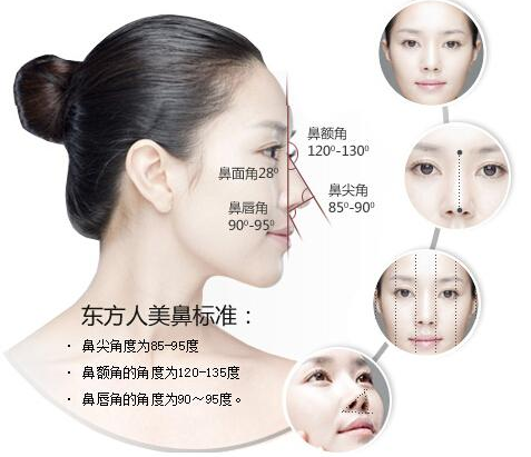 假体隆鼻