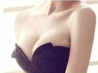 副乳切除