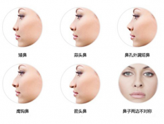 南京做假体隆鼻哪家医院好?