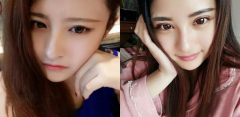 北京蕾士悦李长赋双眼皮怎么样？案例修复多少
