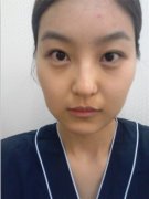 上海当代整形美容医院磨骨做的好不好？