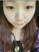 在仪美整形网咨询了做全切双眼皮！好看吗？