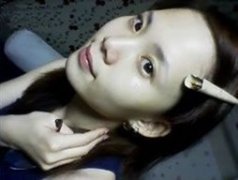 【磨骨+双眼皮+下颚角+下巴+鼻子】我一下全做了