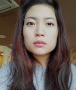 我做了下颌角~面部填充大家觉得怎么样？