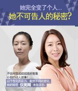 面部轮廓改变？真的可以年轻很多。
