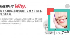 北京张笑天做改脸型磨骨要多少钱