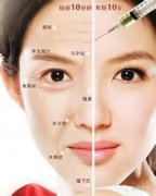 上海百达丽整形医院打除皱针好不好?多少钱?