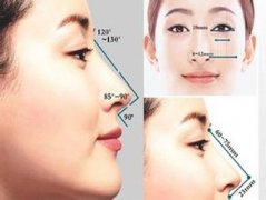 济南海峡整形医院做隆鼻多少钱?怎么样?