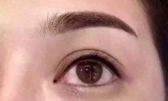 韩式无痕切眉术需要多少钱？
