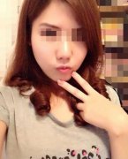 分享我的隆鼻、鼻翼缩小手术恢复历程