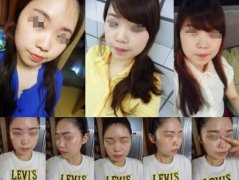 有图有真相，四方女变成锥子脸的亲身经历~