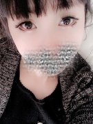 双眼皮手术快两个月了~~