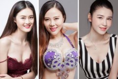 雅美当下最热门的整形项目有哪些?