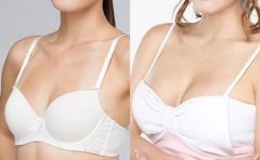 假体隆胸备受欢迎的原因是什么?