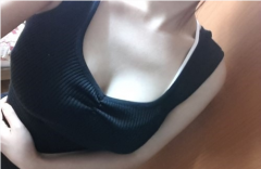 上海哪里做乳房缩小技术好?有没有风险?