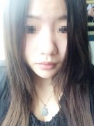 全切加开眼角 一年后的效果绝对惊艳到你们