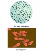 瘦腿针真的能瘦小腿吗?有什么副作用吗？
