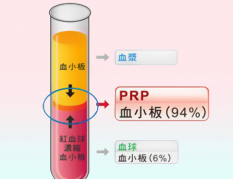 浙江杭州哪家医院做嫩肤效果好？