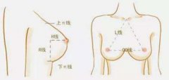 上海哪家医院自体脂肪隆胸效果好？