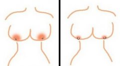 乳晕漂红效果可以保持多久