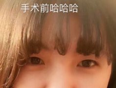 江苏省中医院王金明医生做的全切+眼角