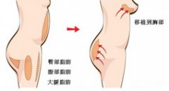 女性坏习惯恐加速胸部下垂