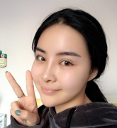 合肥割双眼皮那家好？效果怎么样多少钱？对比