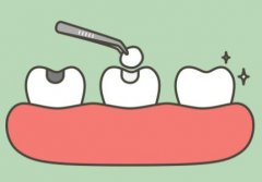 北京口腔医院牙齿种植价格揭秘,小白攻略指南