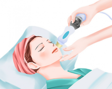 激光祛痘需要多少钱？3分钟搞懂多少钱/次数