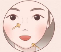 彩光嫩肤祛斑效果好吗？先搞懂原理不被坑