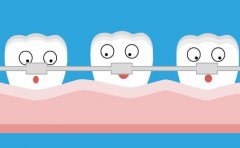 牙性嘴凸矫正花多少钱?费用构成揭晓
