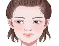 埋线双眼皮：附埋线10天恢复全过程