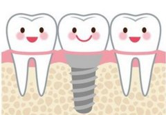 上海种植牙医院:便宜又好的在这!