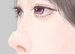 成都做鼻子厉害的医生,这几位口碑超赞~