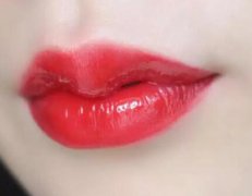 嘟嘟唇打完5天内:每天变化看得见