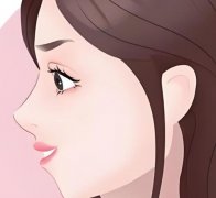 磨骨一年后对比照片查看:脸型变化超明显