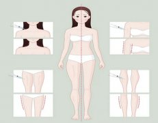 美修斯一个疗程多少钱?2025年收费行情参考