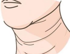 热玛吉：效果 + 副作用一次说清楚