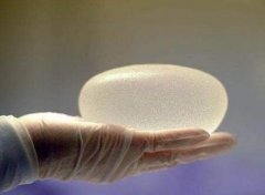 傲诺拉璀璨290cc效果图如何?真人案例速看