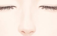 鼻基底填充用什么玻尿酸好?材料清单公布啦