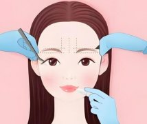 颧骨突出别慌！3种医美矫正方案帮你摆脱烦恼