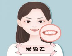 地包天轻微与严重图片如何?自测程度+矫正建议