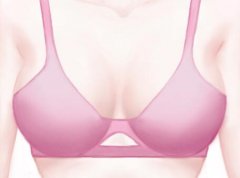 宝俪假体保质期多久?能陪你十年还是一辈子