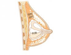乳房缩小提升术有哪些风险?隐患提前了解