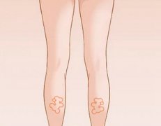 瘦腿针多少钱一次？要打几次？知识点盘点