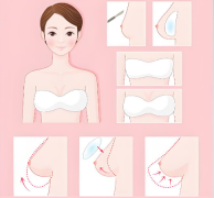 宝俪和傲诺拉那个比较好?全方位battle