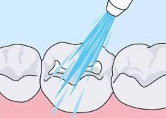 中山三院跟广医口腔|医美界扛把子？戳进对比！